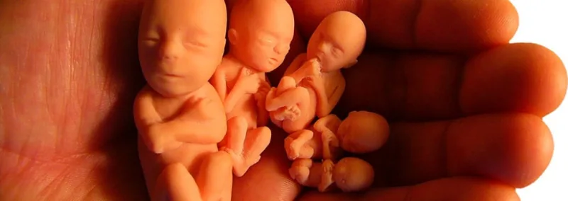 En 2018 fueron abortados casi 42 millones de bebés en el mundo