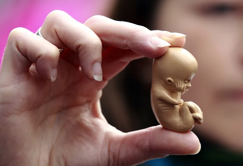 No existe «aborto seguro»